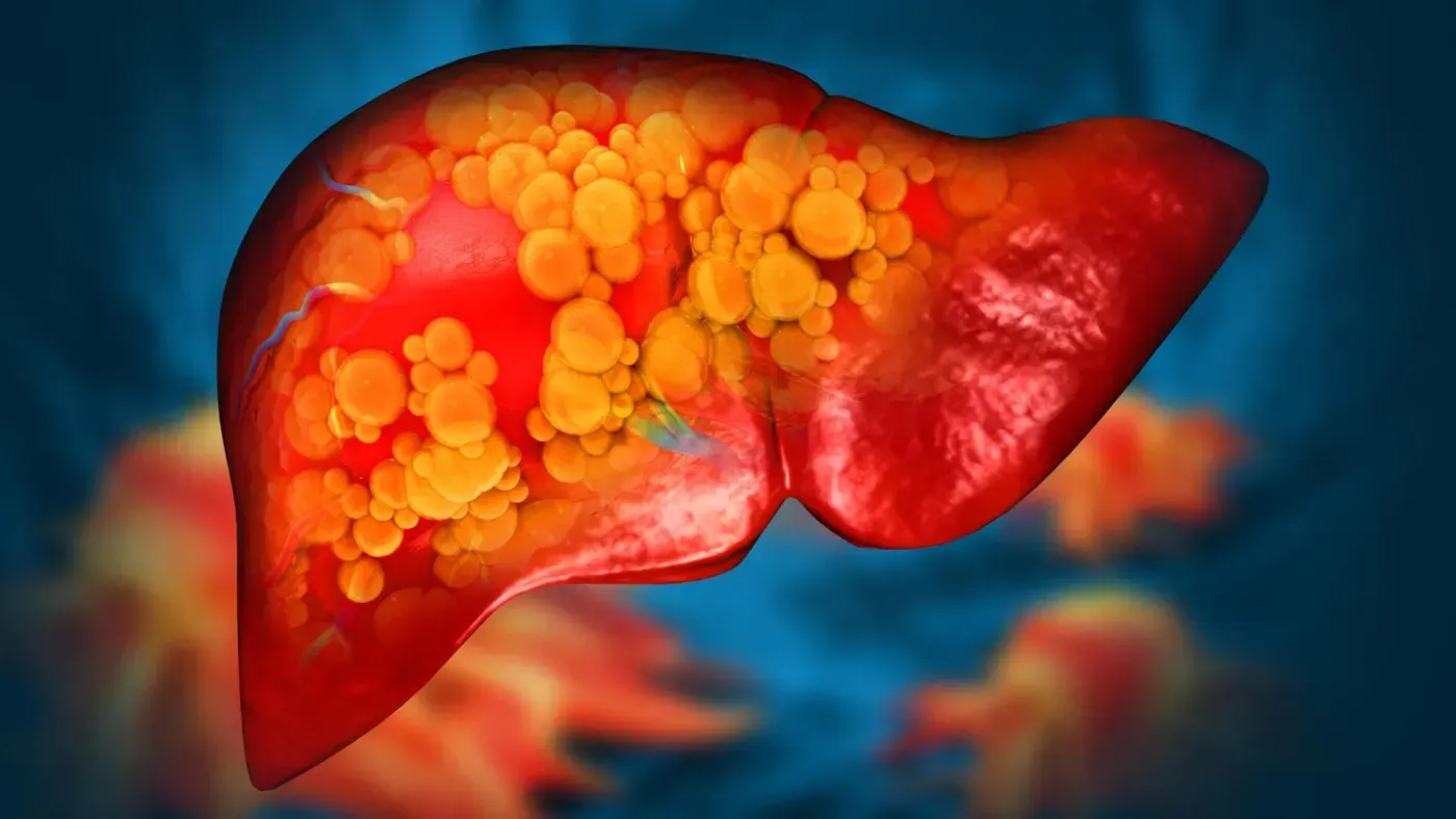 Eating late at night linked to up to 30% higher risk of liver disease