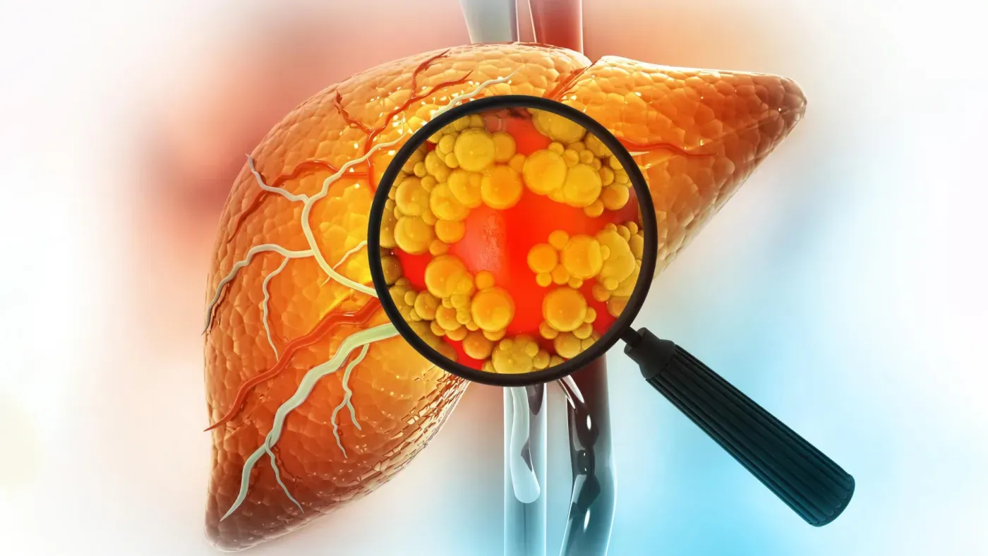 Low testosterone may make sugar far more harmful to your liver