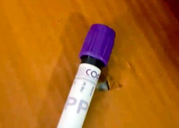 Vial of blood in box close up.