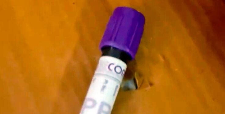 Vial of blood in box close up.