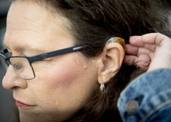 FDA approves sale of over-the-counter hearing aids