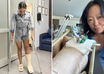 Two Houston TV newswomen break their leg within days