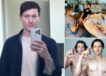 Bryan Johnson posts photo to show off his new 'baby face'