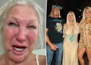 Hulk Hogan’s ex Linda claims daughter Brooke 'broke her collarbone'