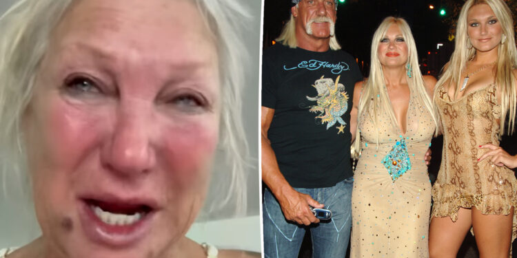 Hulk Hogan’s ex Linda claims daughter Brooke 'broke her collarbone'