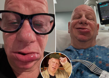 Comedian Jeff Ross 'spent the night in the ER' with allergic reaction to ice cream