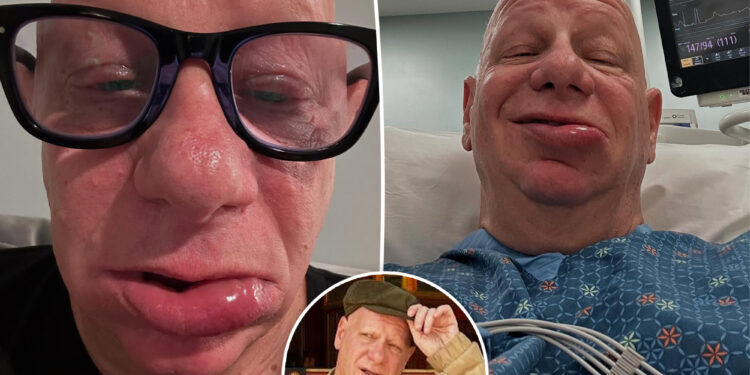 Comedian Jeff Ross 'spent the night in the ER' with allergic reaction to ice cream