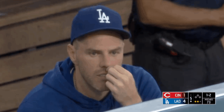 Dodgers star Freddie Freeman grabs ahold of a nose hair in a dugout moment caught on camera.