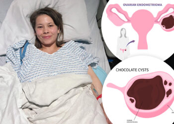What is a chocolate cyst? Bindi Irwin has growth, lensions removed