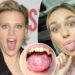 What is 'geographic tongue'? All about 'SNL' star Kate McKinnon's 'gross' condition
