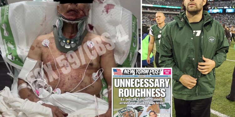 Family of grease truck driver brutally bashed by Mark Sanchez give update on his condition