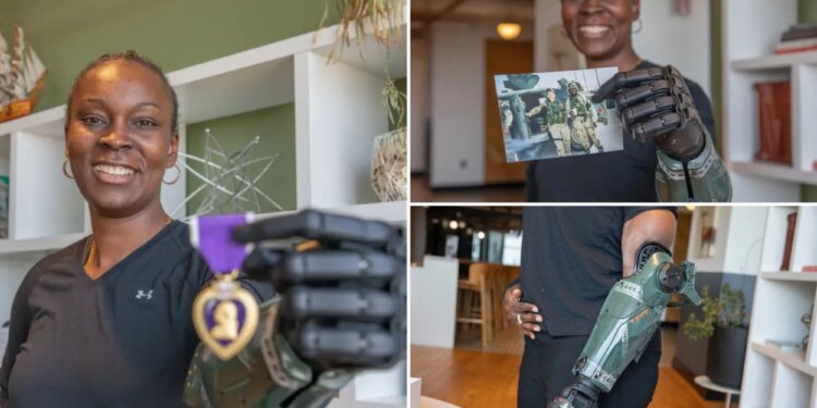 Veteran to become the first to receive new ‘hero’ bionic arm inspired by Call of Duty