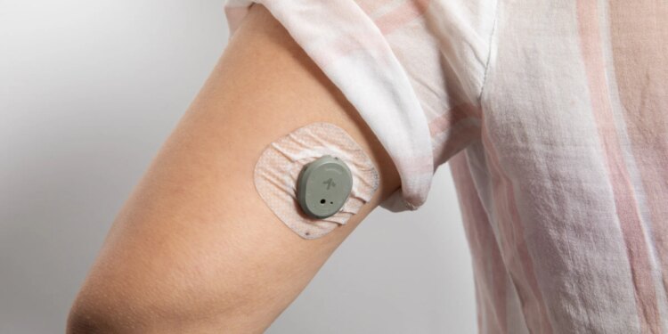 close up of Dexcom Stelo CGM