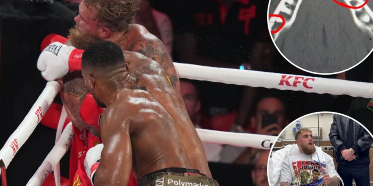 Jake Paul suffered broken jaw in knockout loss to Anthony Joshua