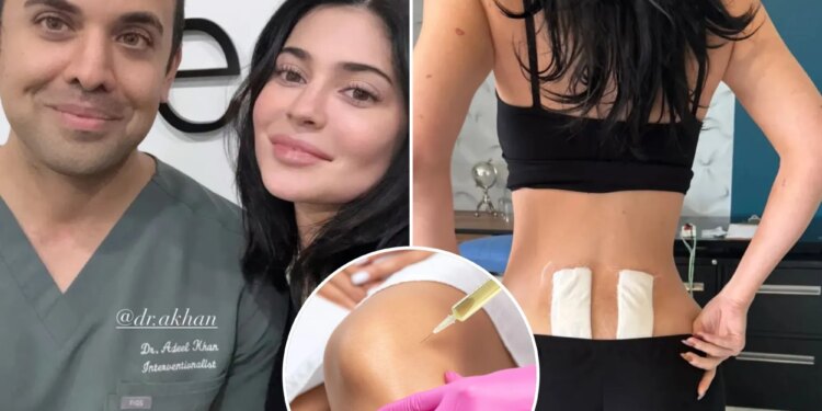 Kylie Jenner seeks stem cell therapy in Mexico
