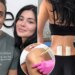 Kylie Jenner seeks stem cell therapy in Mexico