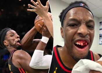 Hawks' Onyeka Okongwu shows off gruesome injury after taking elbow to face