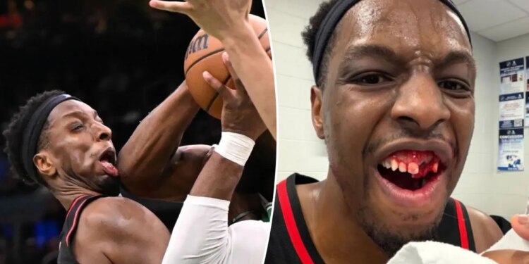 Hawks' Onyeka Okongwu shows off gruesome injury after taking elbow to face