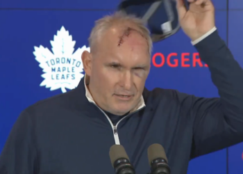 Craig Berube showed off a gnarly cut on his head after what he described a a gym accident.