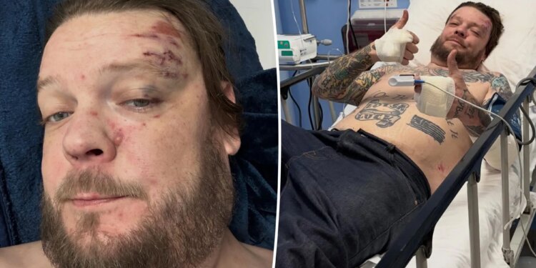 Pawn Stars' Corey Harrison breaks 11 ribs in motorcycle crash