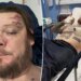 Pawn Stars' Corey Harrison breaks 11 ribs in motorcycle crash
