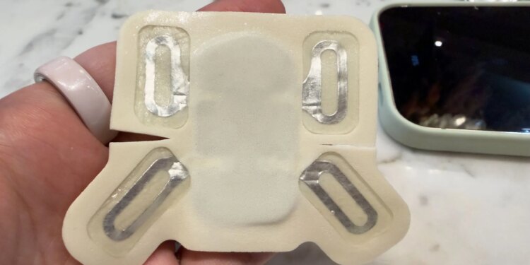 The electrodes that deliver the zap.