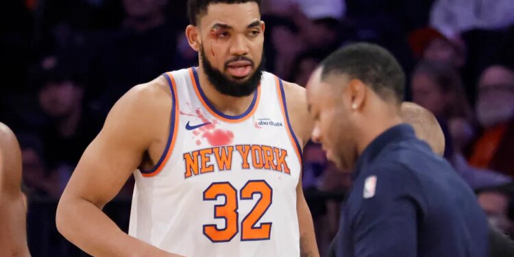 Karl-Anthony Towns with a cut near his right eye and blood on his jersey, being checked by a trainer.