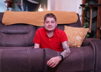 Teen went from 6' to 2'8" after amputation below the waist