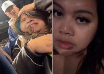 Foul ball 'cracking' skull of woman at Padres game heard around the world