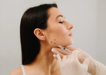 A woman receiving botulinum toxin injections for bruxism treatment.