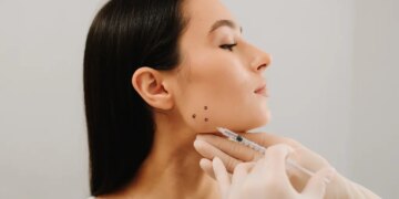 A woman receiving botulinum toxin injections for bruxism treatment.