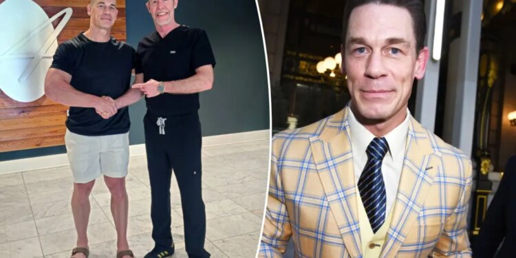 John Cena posts shocking bald photo as part of hair transplants