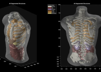 Midjourney Medical goes from AI image generation to full-body ultrasounds
