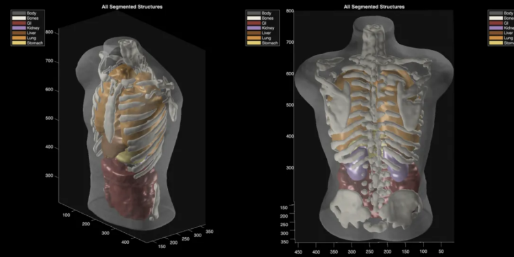 Midjourney Medical goes from AI image generation to full-body ultrasounds