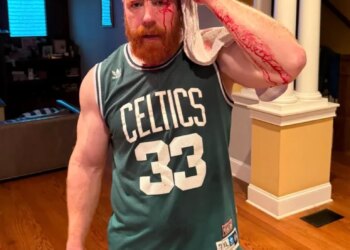 A man with a bloodied face and arm, wearing a green Celtics jersey, holds a white towel to his head.