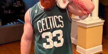 A man with a bloodied face and arm, wearing a green Celtics jersey, holds a white towel to his head.