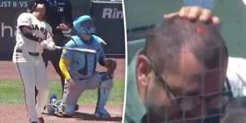 San Francisco Giants fan left bloodied after being struck by foul ball
