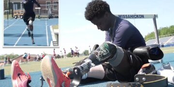 Teen with no arms or legs chases dream of running in the Paralympics